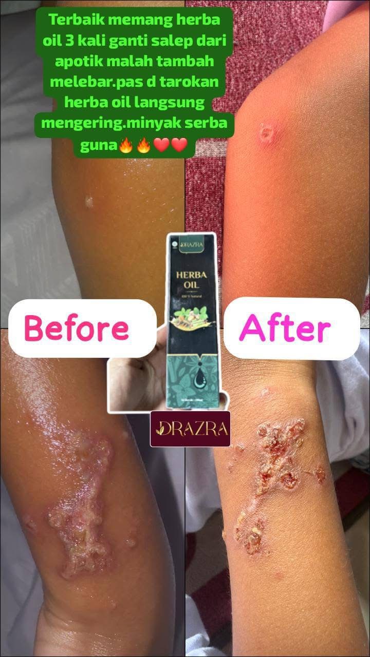 Testimoni pelanggan DRAZRA 2